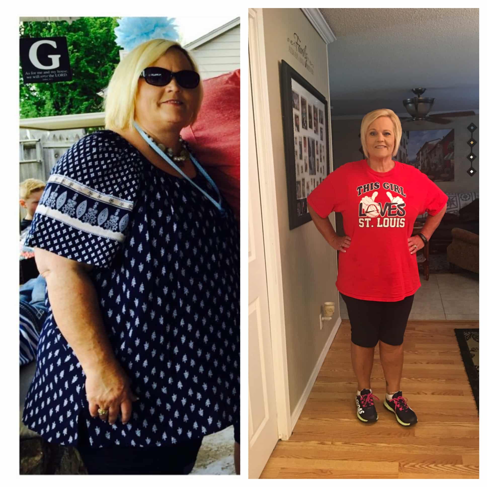 Family Supports Mother Through Weight Loss Surgery