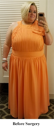 Stacie before weight loss selfie