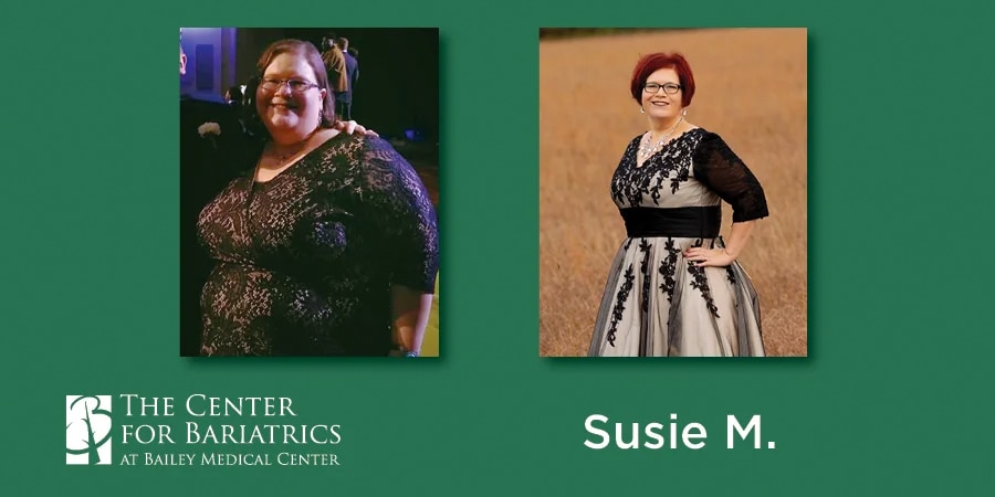 Susie Martin enjoys new outlook on life thanks to Bailey Bariatrics
